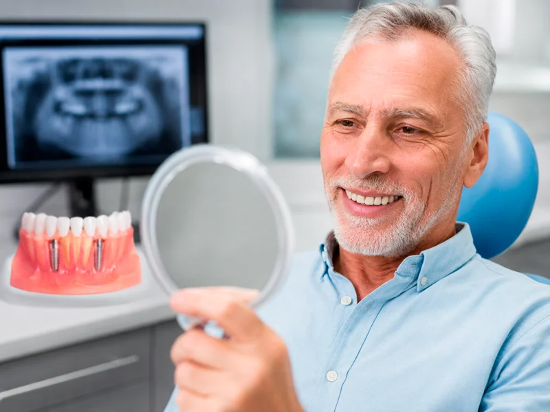 implantes e protocolos